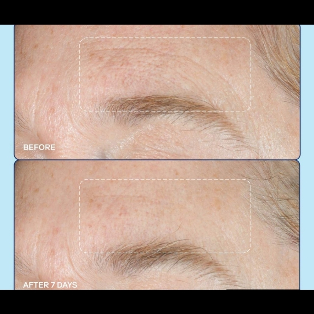 Skinfix SEALED! NIB! Barrier+ Collagen Activating Serum. 1floz/30ml. R2S!! - Picture 4 of 13